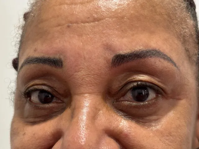 Cliente de pele negra olhando para a câmera, com sobrancelhas em nanobrows feitas na La Vie Clinic, na Vila Galvão, em Guarulhos