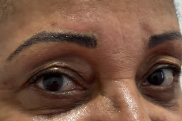 Antes do retoque: sobrancelhas com micropigmentação antiga