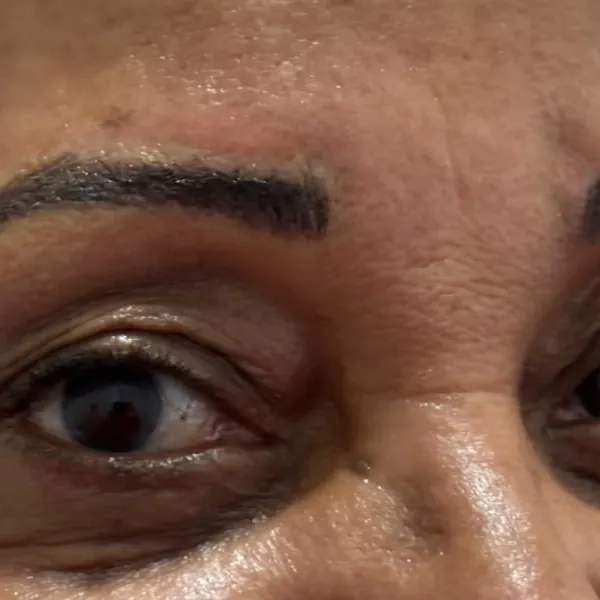 Antes do retoque: sobrancelhas com micropigmentação antiga