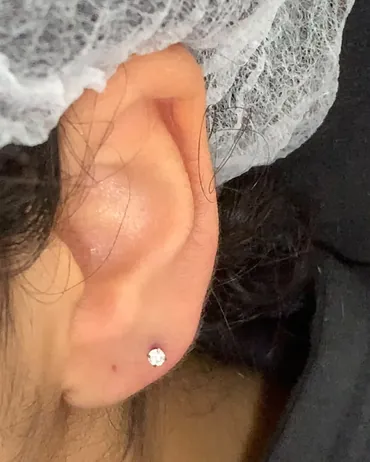 Piercing no lóbulo da orelha, com a cliente de touca descartável
